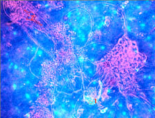 Imágenes de células neurales obtenidas de células madre neurales de cerebro de rata adulta cultivadas sobre biomateriales polimericos 1.