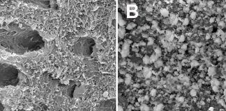 Caries: nuevos materiales dentales, con vidrio bioactivo y flúor, para frenar la degradación y remineralizar los dientes A: Dentina desmineralizada que presenta una cantidad de fibras de colágeno que, si no son preservadas y remineralizadas, pueden degradarse por la acción de las enzimas proteolíticas dentinales. B: Dentina tratada con resina con vidrio bioactivo enriquecida con flúor, que presenta precipitaciones minerales como signos de remineralización. FOTO: S. Sauro.