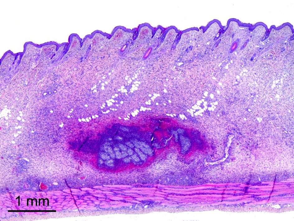 Aspecto microscópico a los 3 días tras la infección.