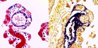 Hallan una nueva ruta de infección por vía linfática en una bacteria que se contagia de caballos a humanos Imagen de bacterias Streptococcus equi de la subespecie analizada, en color morado, invadiendo el intestino de las alpacas a través de los vasos linfáticos.