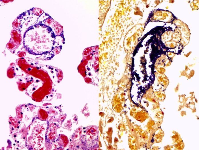 Imagen de bacterias Streptococcus equi de la subespecie analizada, en color morado, invadiendo el intestino de las alpacas a través de los vasos linfáticos.