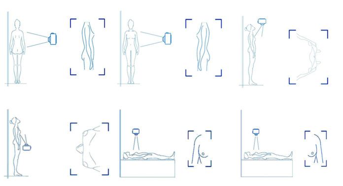 Fragmento de la checklist del primer protocolo para la toma de fotografías previas a la cirugía del cáncer de mama, diseñado por la CEU UCH y la UNAM.