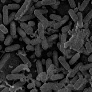 Imagen microscópica de bacterias del género Listeria.
