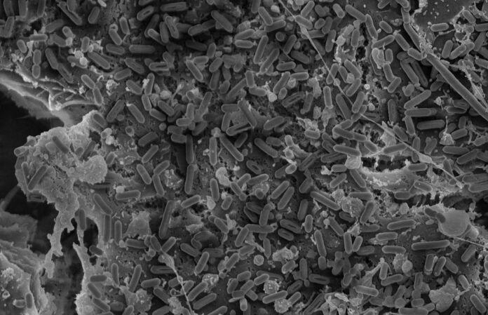 Imagen de la bacteria Listeria monocytogenes, estudiada en cerdos en España por investigadores de la CEU UCH de Valencia, la Universidad de Córdoba y el Instituto Pasteur de París.