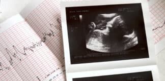 Un estudio confirma que las mujeres vacunadas frente al SARS-CoV-2 presentan síntomas más leves y menor riesgo de complicaciones obstétricas