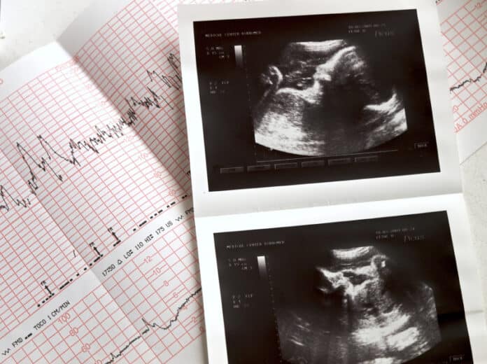 Analyses of the fetus